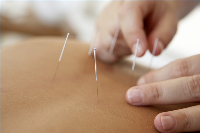 Dr Nekessa Remy is a certified Medical Acupuncturist & Traditional Chinese Acupuncturist